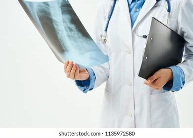 Xray Surgery Traumatology Radiograph Stock Photo Shutterstock