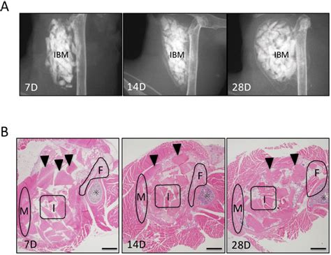 Evaluation Of Ectopic Bone Formation A Soft X Ray Imaging Of Ibm At