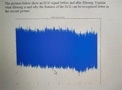 The Pictures Below Show An Ecg Signal Before And Chegg