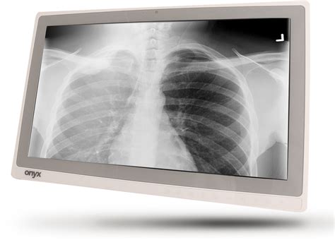 X Ray PNG Transparent Images