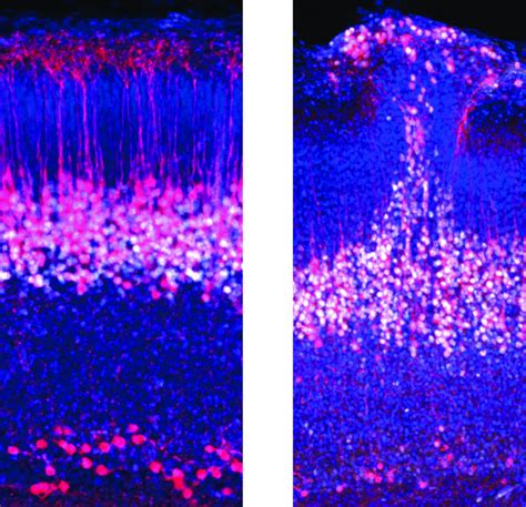 Wt Vs Autism Cortex [image] Eurekalert Science News Releases