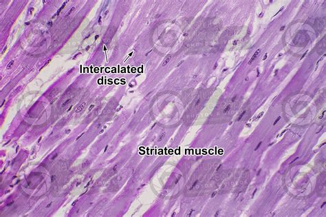 Cardiac Muscle Tissue Intercalated Discs