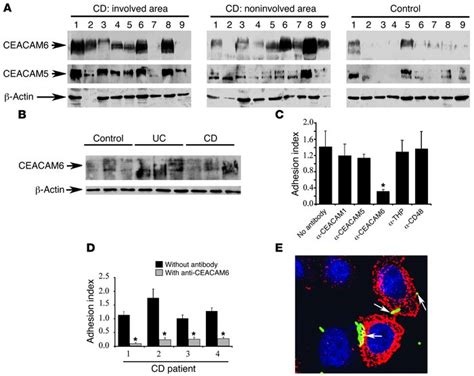 Jci Ceacam6 Acts As A Receptor For Adherent Invasive E Coli Supporting Ileal Mucosa