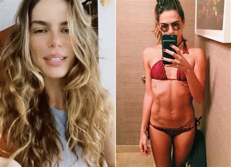 Mariana Goldfarb Fala Sobre Sa De Mental E Relembra Anorexia Triste