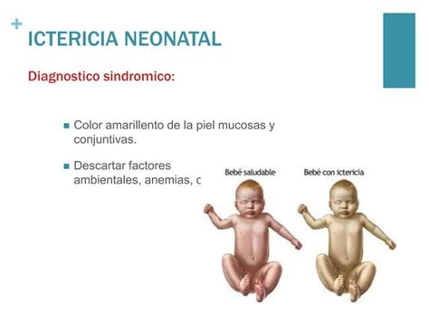 ICTERICIA NEONATAL PPT