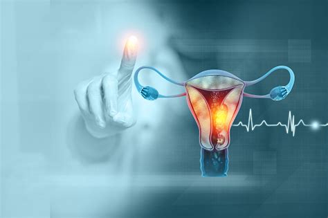 Female Reproductive System Diseases Uterus Cancer And Endometrial