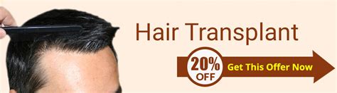 Hair Transplant in Karachi | Best Hair Transplant in Pakistan