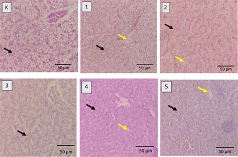 Figure 1 From Kidney And Liver Histopathology Of Sea Bass Lates