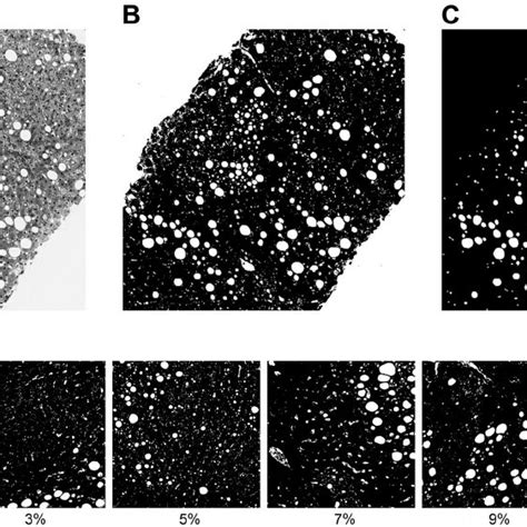 Example of histology images and morphometric image analysis. A ...