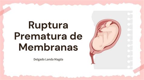 Ruptura Prematura De Membranas Jessy Gonz Lez Udocz