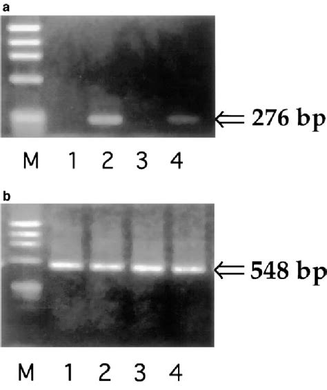 Detection Of Rantes Mrna By Rt Pcr Normal Human Bronchial And Nasal