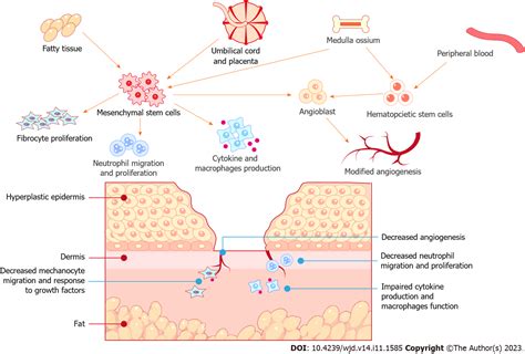 Mesenchymal Stem Cells Based Drug Delivery Systems For Diabetic Foot