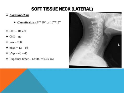 Soft Tissue Neck Radiography Routine And Special Powerpoint Slides