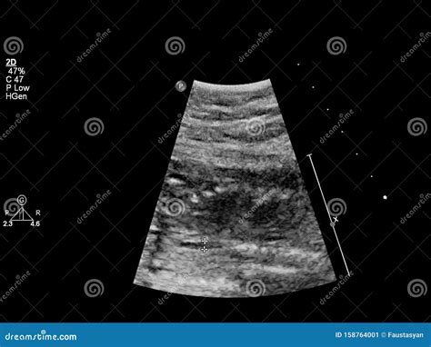 Ultrageluid Van Het Hart Van De Foetus Stock Illustratie Illustration