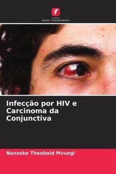 Libro Infec O Por Hiv E Carcinoma Da Conjunctiva Nanzoke Theobald