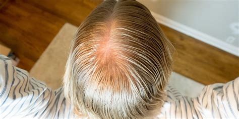 Receding Hairline Older Mens Hairstyles Thinning Hair Your Holiday