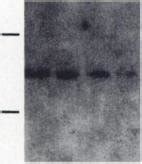 Effect Of ETS1 Sense And Antisense Oligonucleotides On The Level Of