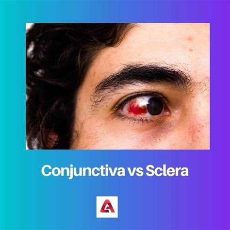 Conjunctiva vs Sclera: Difference and Comparison