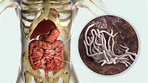los  tipos de parasitos  sus caracteristicas muy salud