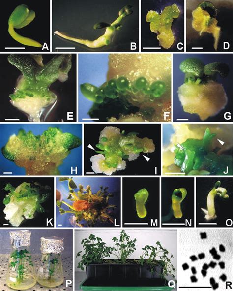 In Vitro Culture And Plant Regeneration Via Somatic Embryogenesis From