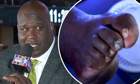 Shaquille O Neal Horrifies Viewers With Gross Foot Daily Mail Online