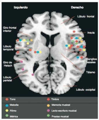 Resonancia Magn Tica En Proyecci N Axial Cerebral Garc A Casares