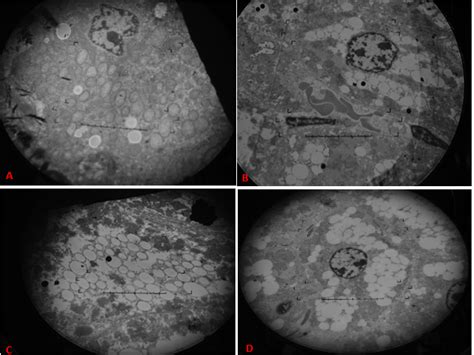 Transmission Electron Microscopy Of Liver Sections From Experimental