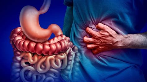 3 causas de la sangre en las heces que no son cáncer de colon BBC