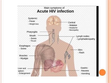 Oral Manifestations In Hiv Disease