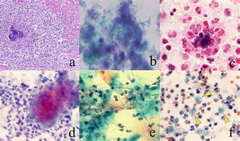 Cytological Diagnosis Of Infectious Diseases Identification Of Pathogens And Recognition Of