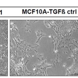 Overexpression Of Esrp Inhibits Emt In Mcf A Cells A Bright Field