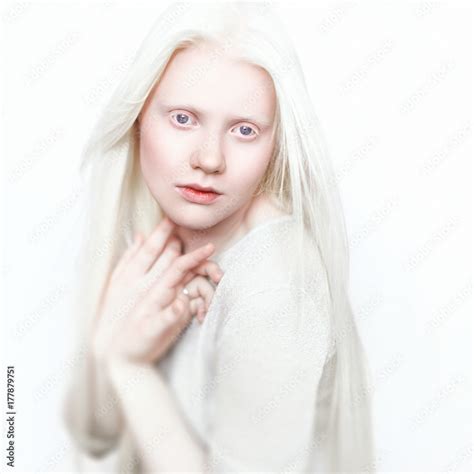 Albino Girl With White Skin Natural Lips And White Hair Photo Face On A Light Background