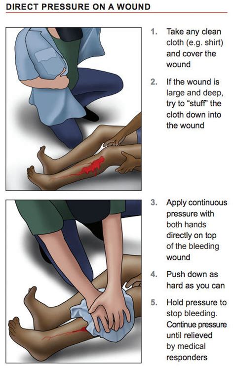 Lessons From A Stop The Bleed Class Cleveland