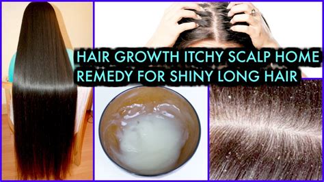 Top 48 Image Itchy Scalp And Hair Loss Vn