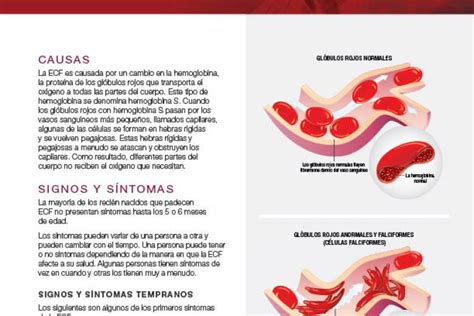 Hoja Informative Controlar El Dolor Con La Enfermedad De Células Falciformes Managing Pain