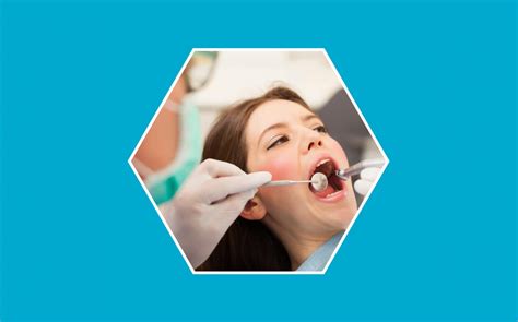 Curetaje Dental En Qu Consiste Blog Doctorgo