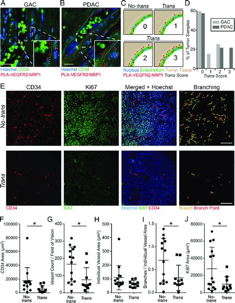 Vegfr2nrp1 Trans Complexes Associated With Reduced Tumor Vasculature