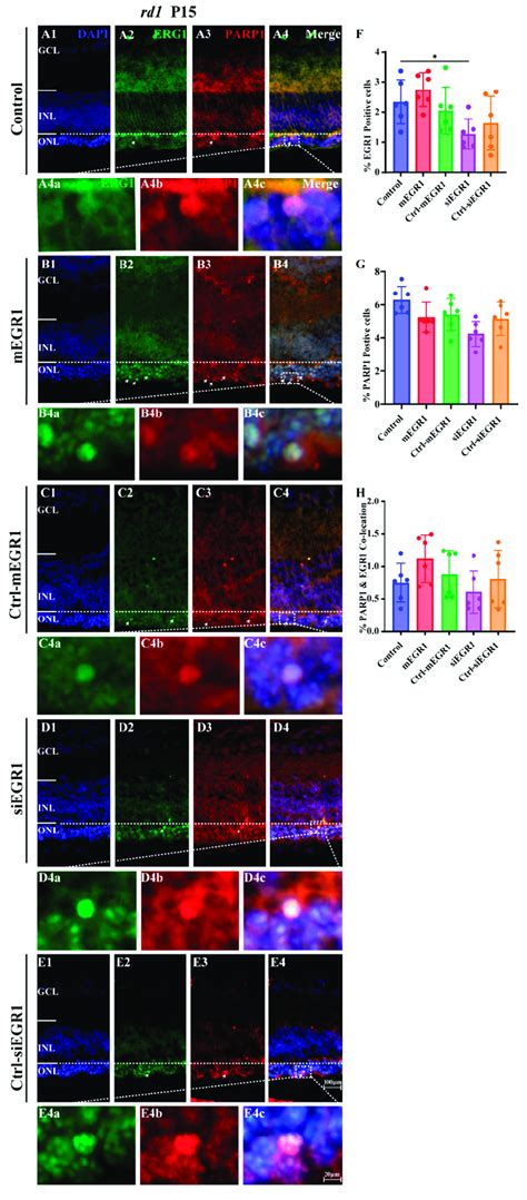 EGR1 And PARP1 Expression Colocalize In Rd1 Photoreceptors At P5 Rd1