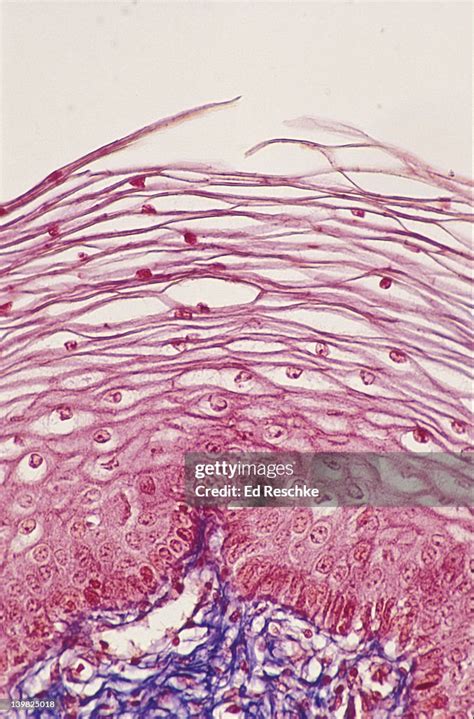 Photomicrograph Of Stratified Squamous Epithelium Of The Vagina Showing