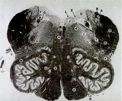 Rostral Medulla Cross Section Diagram Quizlet