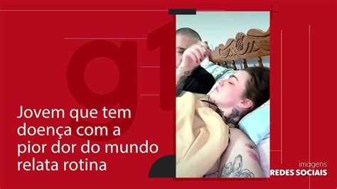 Vídeo Jovem que tem doença a pior dor do mundo relata rotina