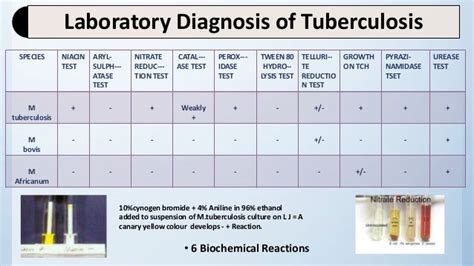 Laboratory Diagnosis Of Tuberculosis Pract