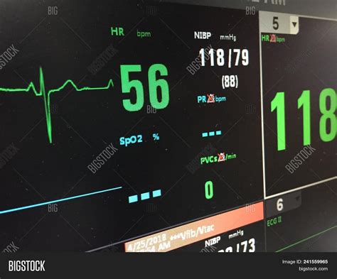 Heart Rate Monitor Image And Photo Free Trial Bigstock