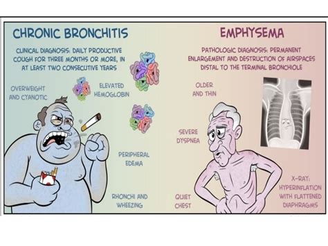 Respiratory System Emphysema Chronic Bronchitis