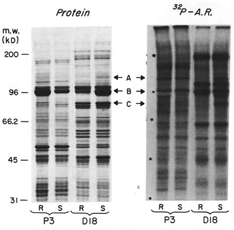 Sds Polyacrylamide Gel Electrophoresis And Autoradiogram Of The