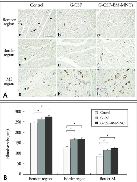 Analysis Of Blood Vessel Endothelial Cells By Anti Von Willebrand