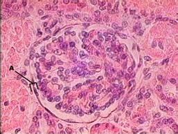 Simple Squamous epithelium Diagram | Quizlet