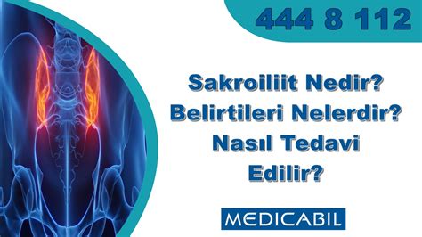 Blog Sakroiliit Nedir Belirtileri Nelerdir Nas L Tedavi Edilir