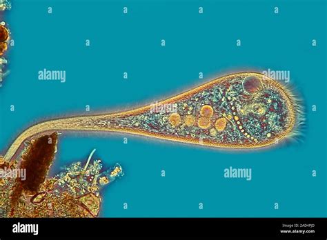 Stentor Protozoan Interphako Contrast Light Micrograph Of A Stentor Sp