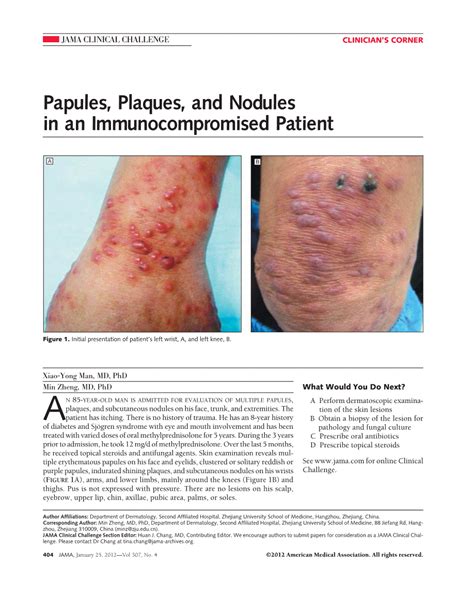 Papules Plaques And Nodules In An Immunocompromised Patient